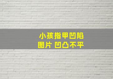 小孩指甲凹陷图片 凹凸不平